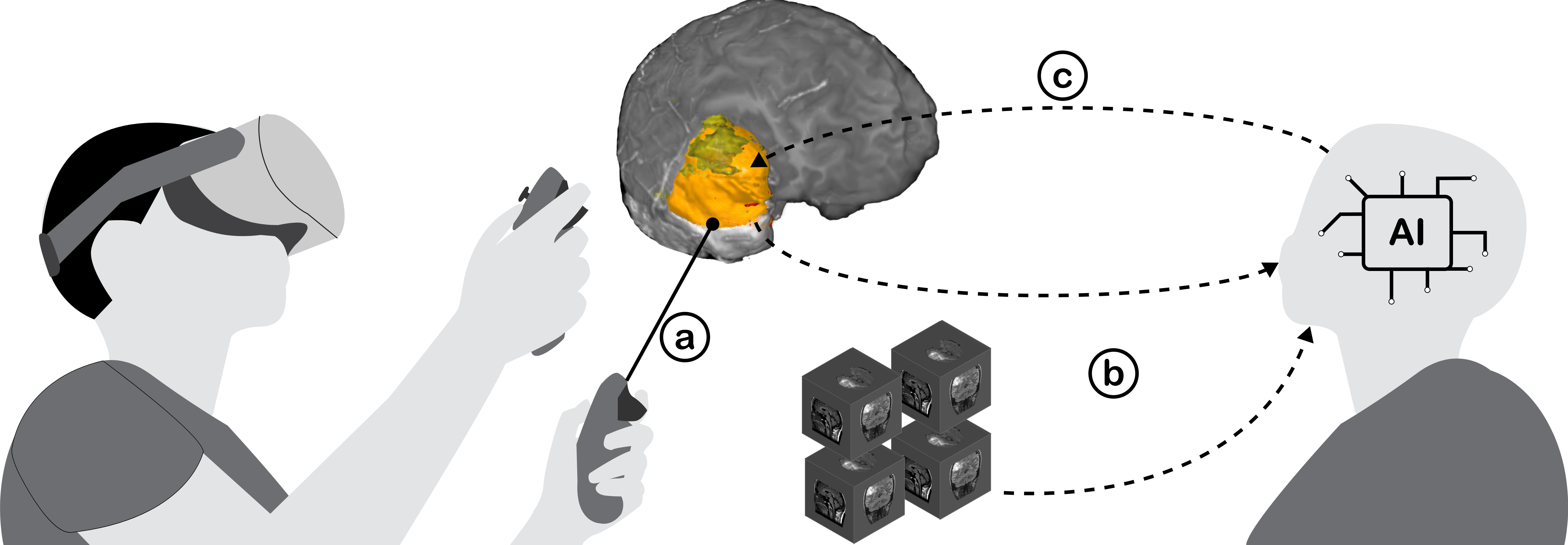 Brain Tumour Segmentation Tool
